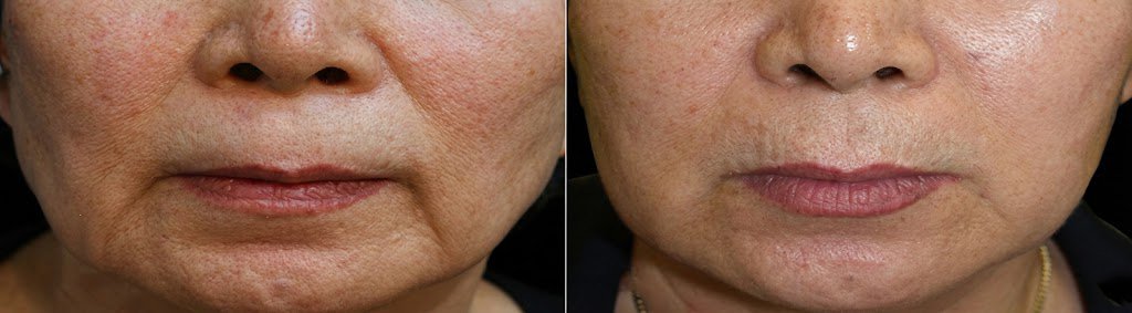 Before and after photos, case 3