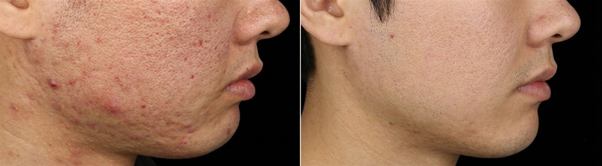 Before and after photos, case 4