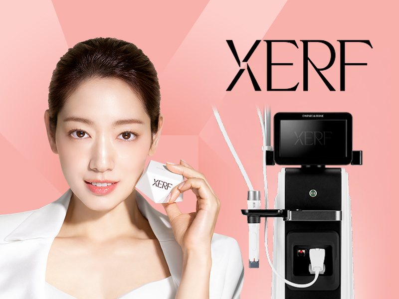 Xerf radiofrequency lifting device